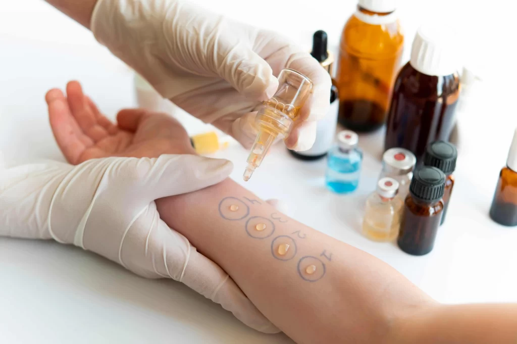 alergias-respiratorias-tratamento-alergologista-natal-policlinica9